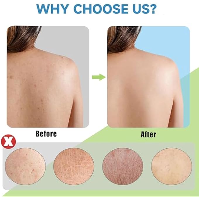 Duomama 2PCS Exfoliating Net - Large 80x30cm White & Brown Sponge for Deep Cleansing, Removing Dead Skin, Oil & Dirt - Soft yet Durable for Daily Use - Image 5